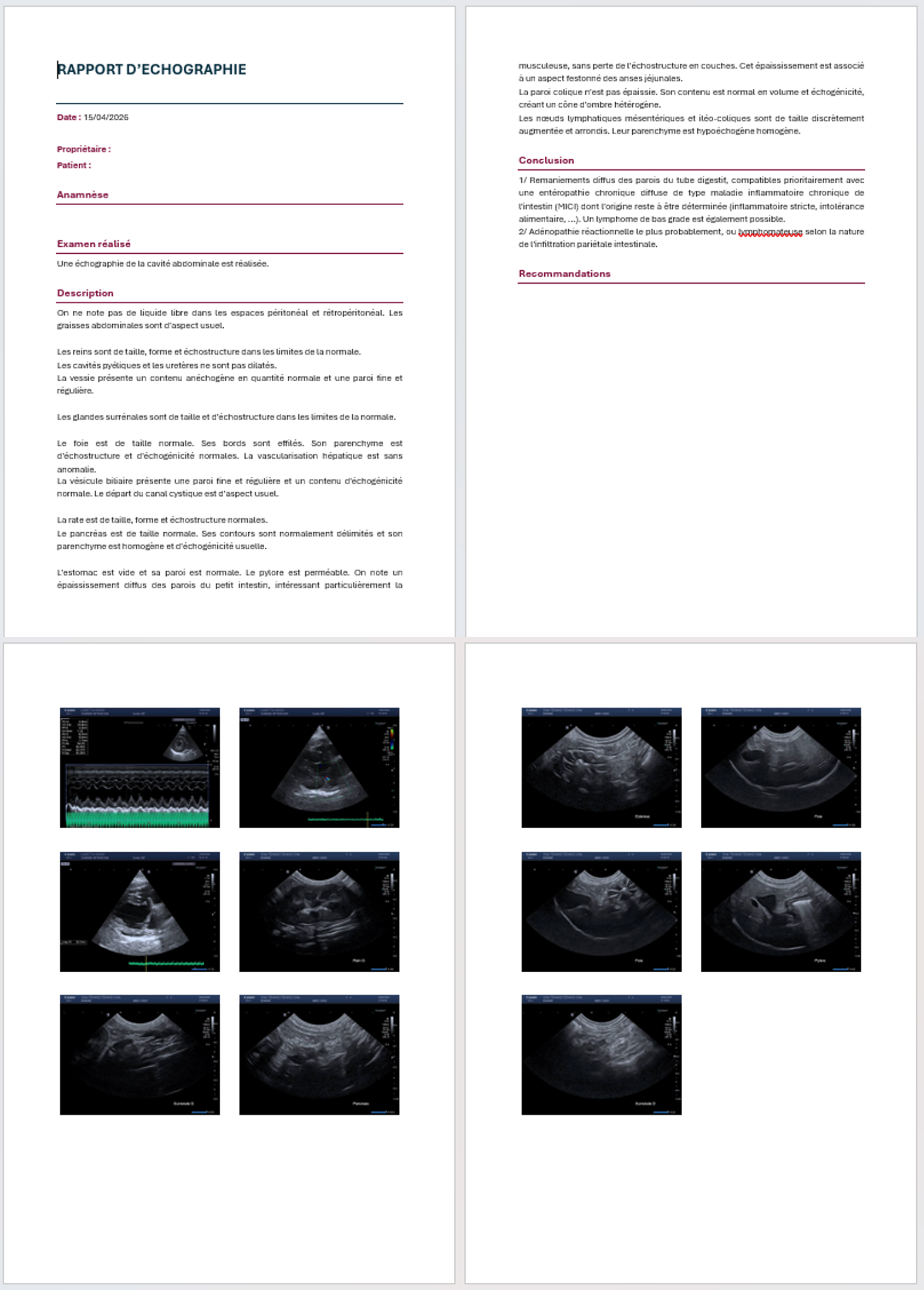 SOPHIA - Export Compte-rendu Word